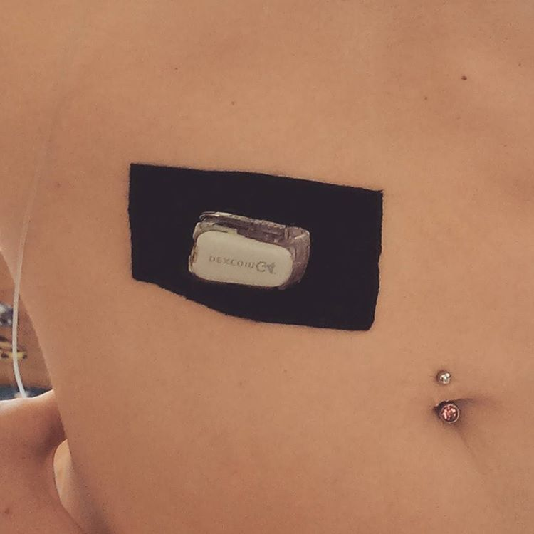 CGM - мой друг