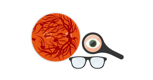 Школа диабета 2. РЕТИНОПАТИЯ