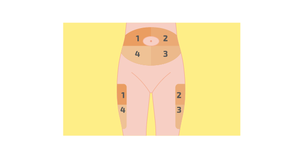 Школа диабета 3. МЕСТА ИНЪЕКЦИЙ ИНСУЛИНА