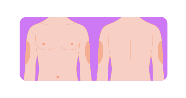Школа диабета 3.4 Плечо
