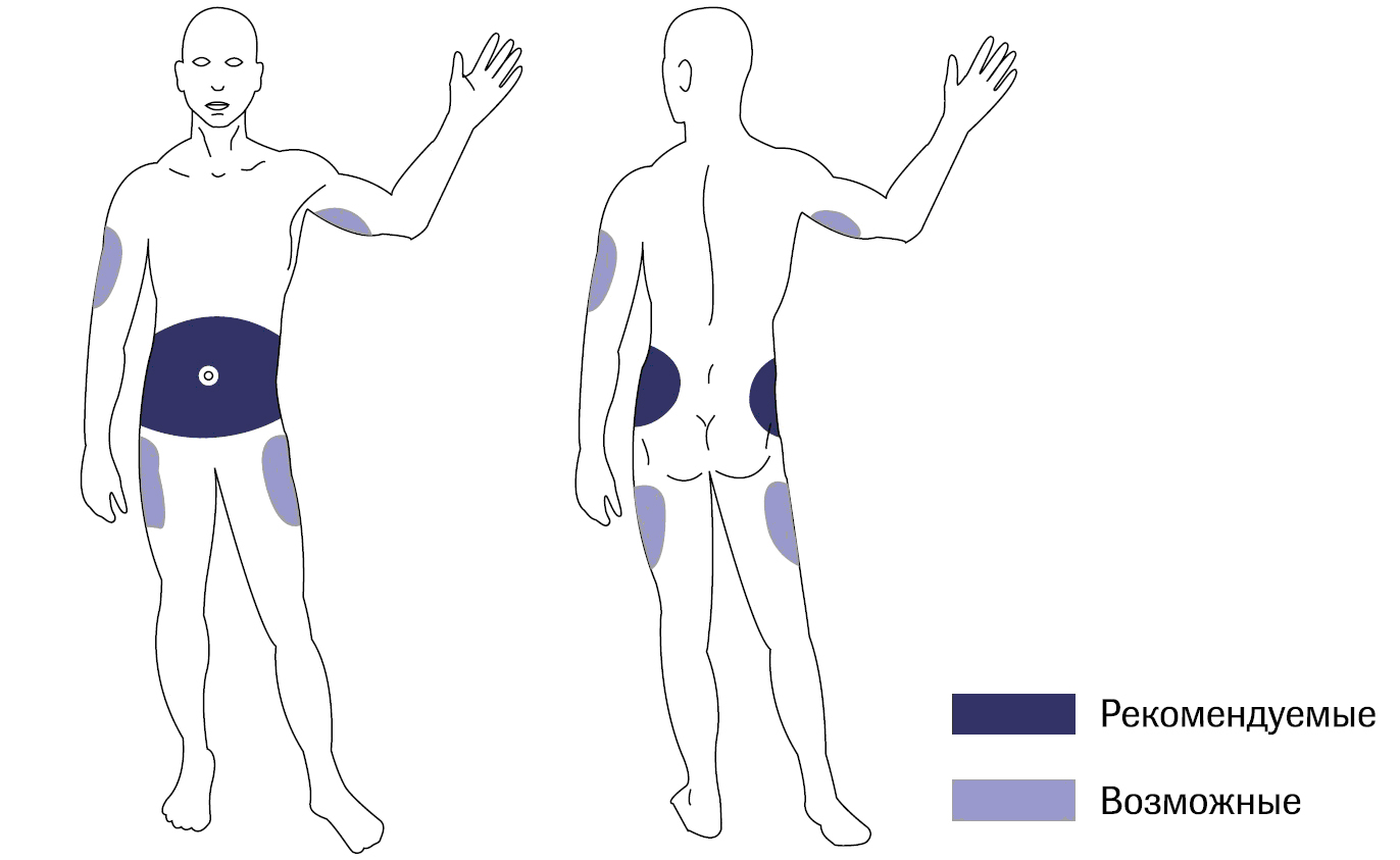 Lifehack: жизнь с помпой. Диабет, сахарный диабет, СД1 типа, СД 2 типа, Правило 15.