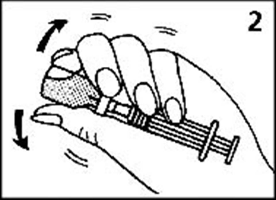 Инъекции глюкагона – зачем, кому и как?Диабет, сахарный диабет, СД1 типа, СД 2 типа, Правило 15.