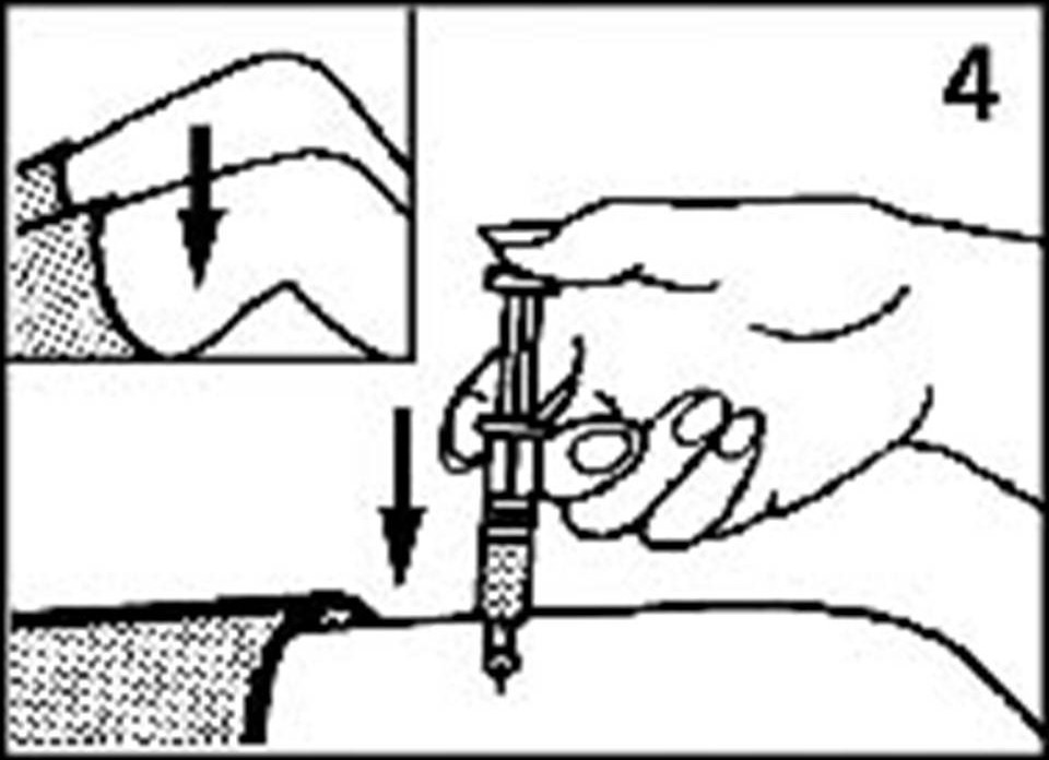 Инъекции глюкагона – зачем, кому и как?Диабет, сахарный диабет, СД1 типа, СД 2 типа, Правило 15.