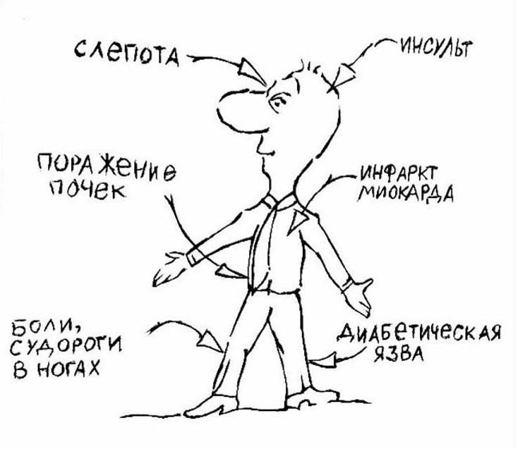 Необходимая частота самоконтроля уровня глюкозы при СД2.Диабет, сахарный диабет, СД1 типа, СД 2 типа, Правило 15.