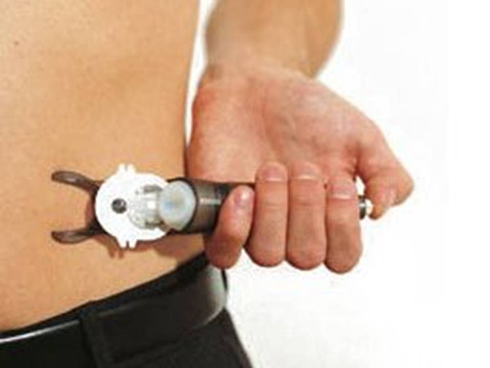 Инфузионные системы для постоянной подкожной инфузии инсулина (ППИИ)..Диабет, сахарный диабет, СД1 типа, СД 2 типа, Правило 15.